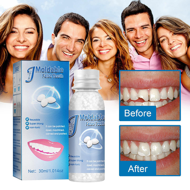 SmileFill™ Instant Tooth Fix